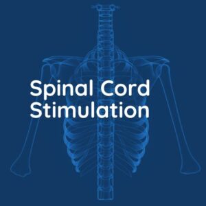 Spinal Cord Stimulation