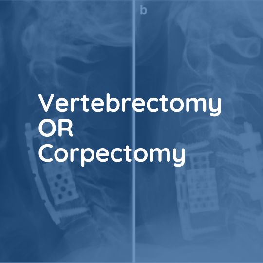 Vertebrectomy OR Corpectomy